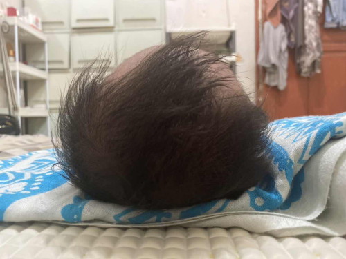kepaka bayi