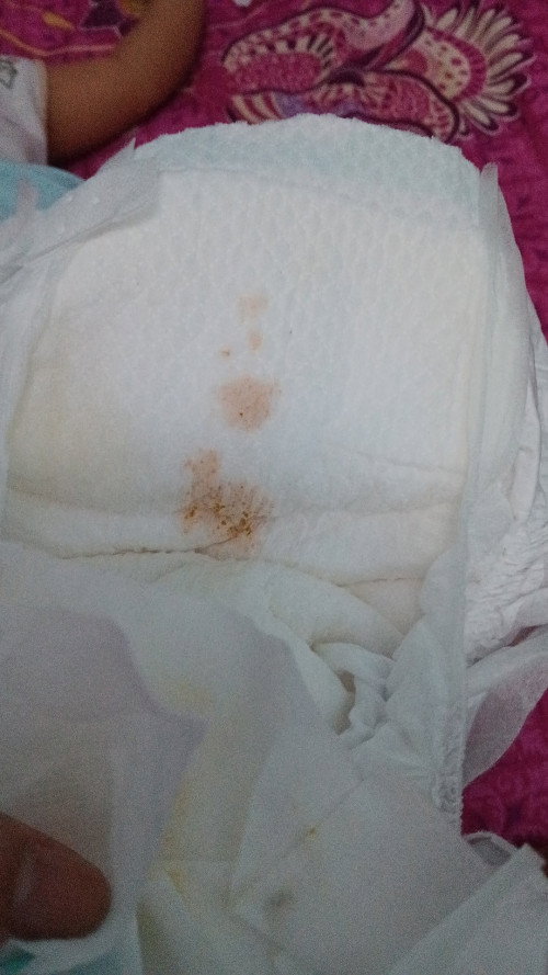 Pup Bayi 1 Bln