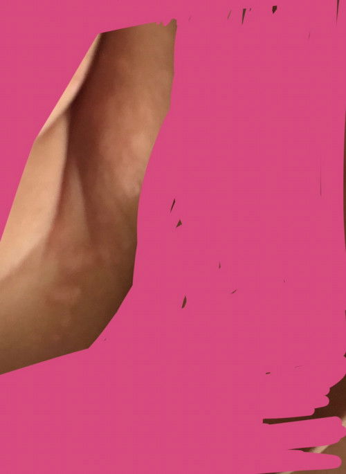 แม่ๆคะน้องเป็นผื่นขึ้นแบบนี้เกิดจากอะไรคะ