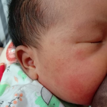 mohon solusi