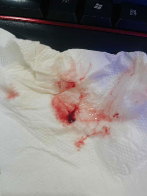 สอบถามแม่ๆค่ะ