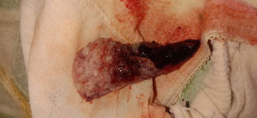 Apakah ini keguguran?