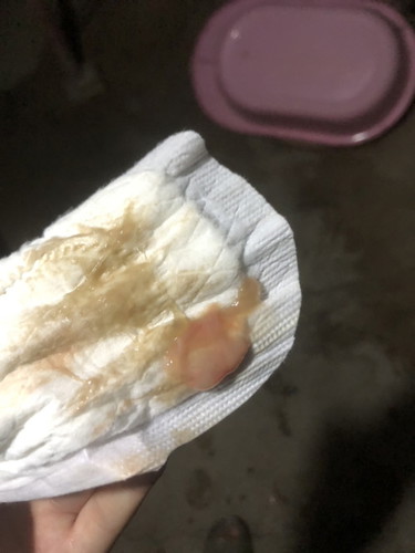 อาการใกล้คลอด