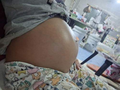 มีแต่คนทักว่าท้องโตจังค่ะ