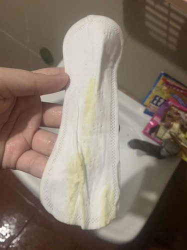 Yellow green discharge