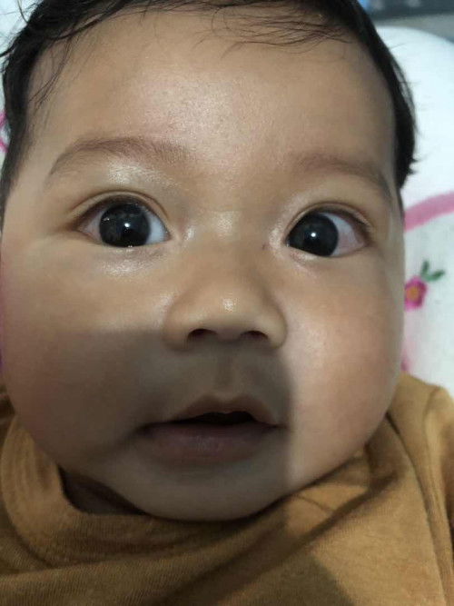 ลูกขอบขยี้ตาเวลาง่วง