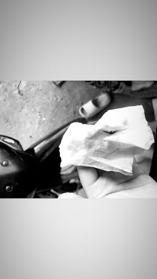 มีมูกเลือด แต่ไม่มีอาการปวดท้อง ไม่มีน้ำเดิน 38+5