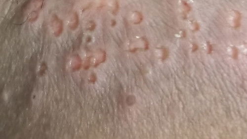 Bunda semoga ada yg bisa bantu