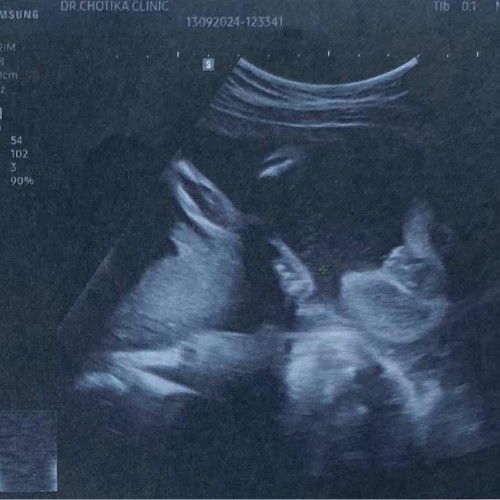 ดูตรงไหนคะแม่ๆ