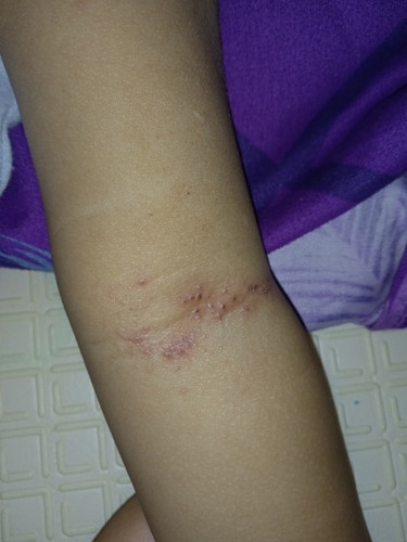 Gatel bayi 18 bulan