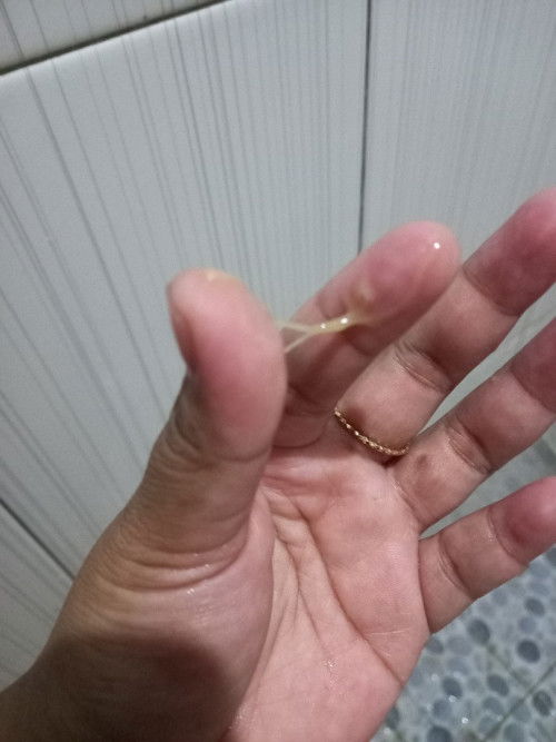 Keputihan atau flek?