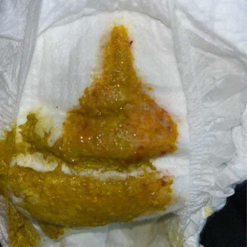 Najis Baby 1 Bulan 18 hari