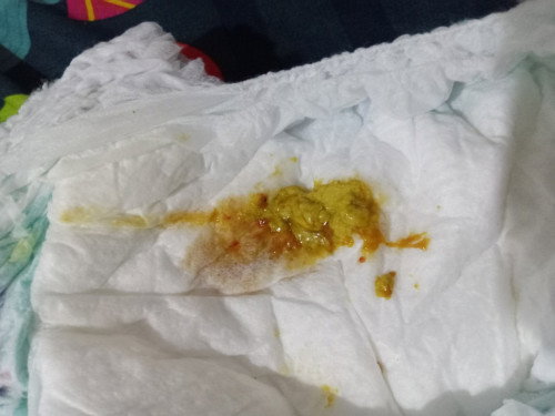 Anakku hbis Dpt2,rotavirus,polio tetes diare bun,aku priksa katanya disentri krna berlendir&berdarah