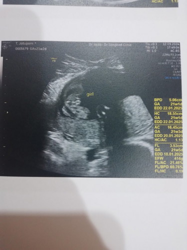 เพศลูก แม่ๆช่วยดูหน่อยซิคะ ว่าน้องเพศอะไร เเม่ดูไม่ออกเลยคะ เเต่คุณหมอบอกว่าคุณเเม่ได้ลูกสาว