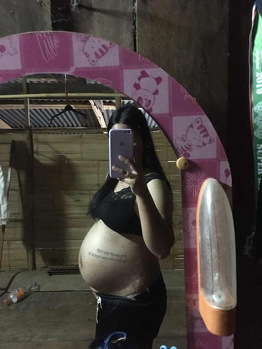 32 วีค ท้องแบบนี้น้องกลับหัวรึยังคะแม่ๆ