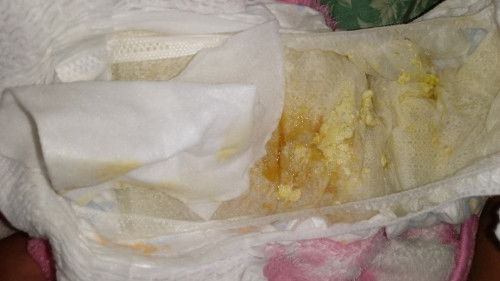 คัยกินข้าวอยุ่ขอโทดด้วยนะคะ