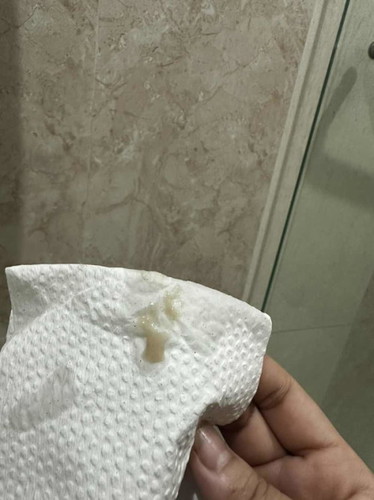 Is this normal?