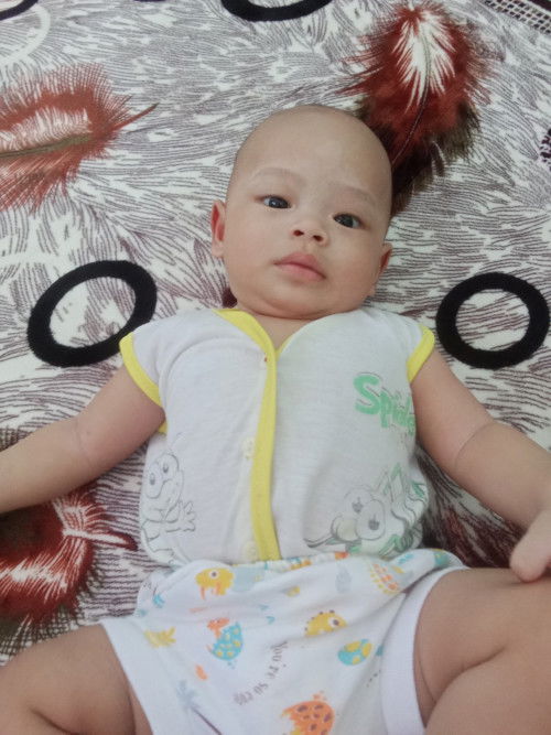 Bercak putih di bagian alis tips dong bun gimana cara menghilangkan soalnya makin melebar