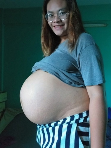 การผ่าคลอด