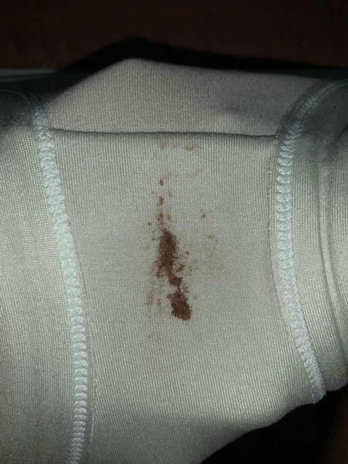 Flek coklat bahaya atau enggak?