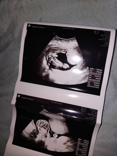 แม่ๆบ้านไหนรู้เพศน้องยังค่ะบ้านนี้อยากได้ลูกผู้ชายเพราะมีลูกผู้หญิง3คนและ