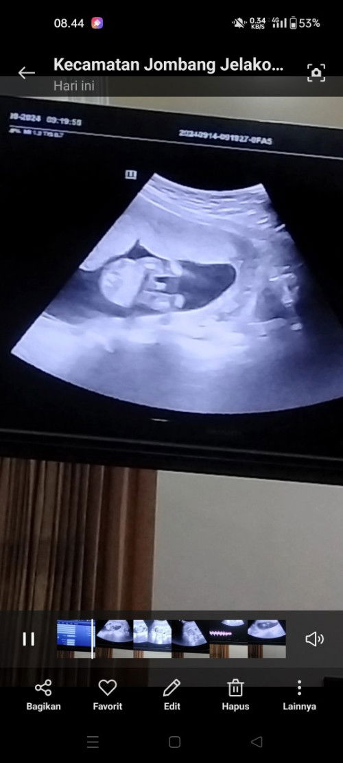 Ada yg sudah usg di 16w ini???