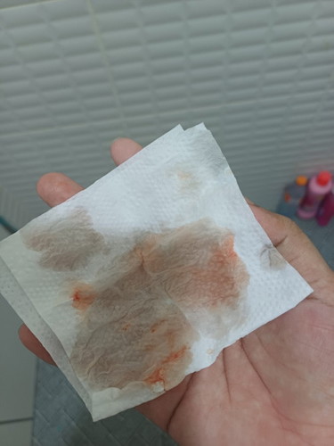 38+3มีเลือดออกแบบนี้ ครั้งเดียวไม่มากต้องไปหาหมอมั้ย