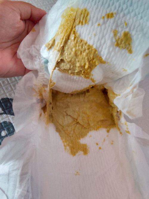 Poop bayi 3 bulan setelah ganti sufor