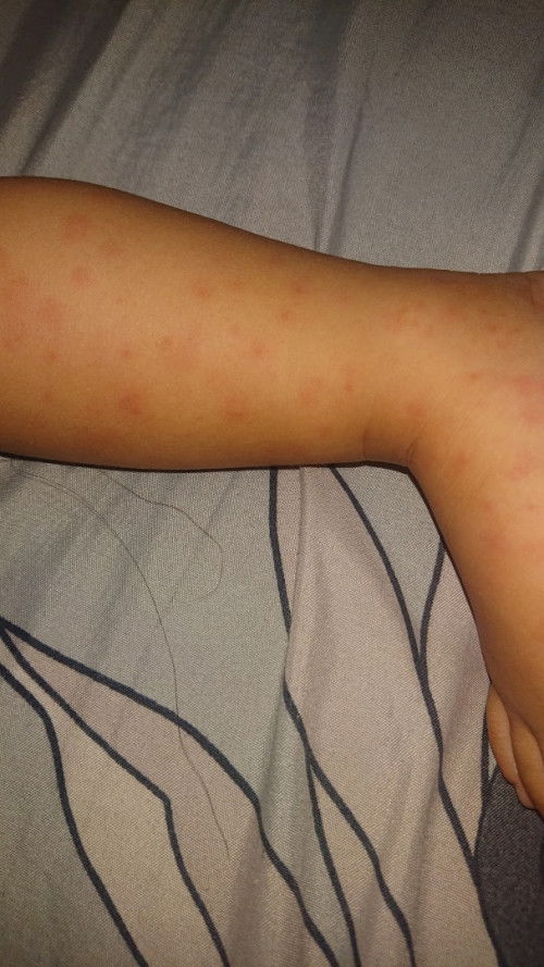 dabagen usia 16 bulan