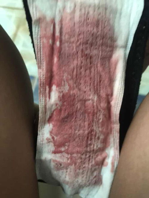 เลือดสีแบบนี้คืออะไรหรอค่ะ