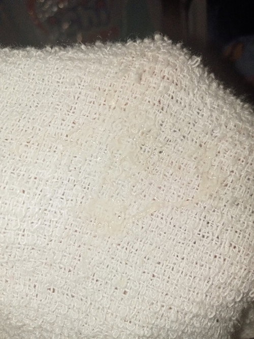 im 33 weeks napo ok lang po kaya ang discarge na ganito white po sya and wala naman po amoy pansin k