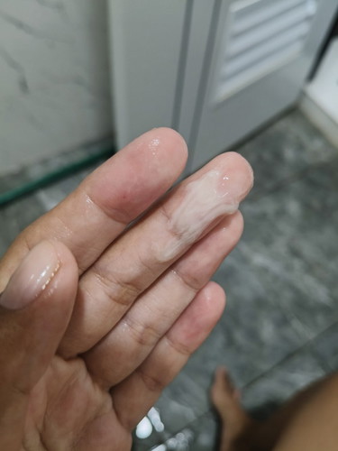 แบบนี้คืออะไรคะ ออกมาเยอะมากๆ