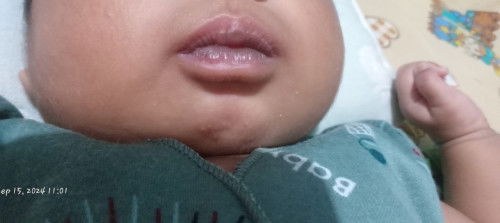 Bibir bagian dalam bayi hitam