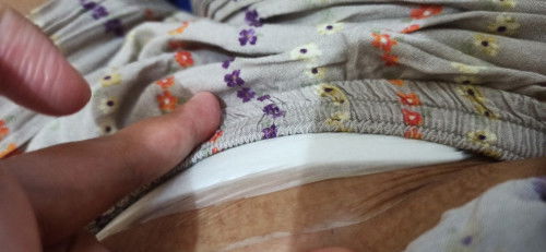 Perban menggelembung