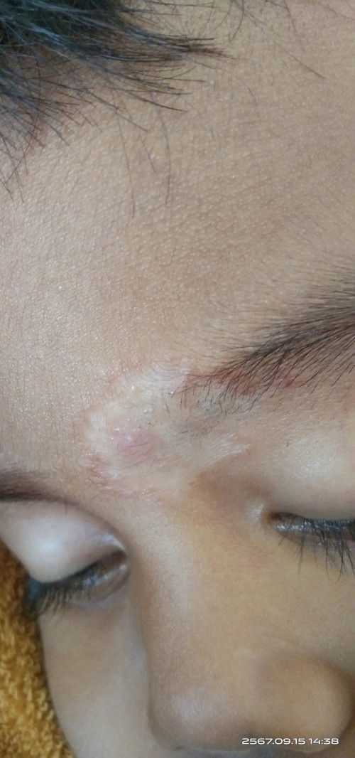 เชื้อราแมวหรือป่าว