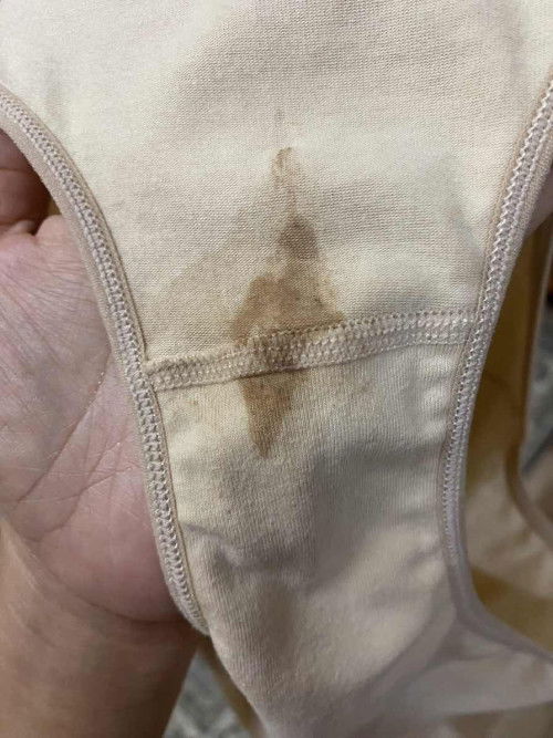 another episodes of brownish spotting