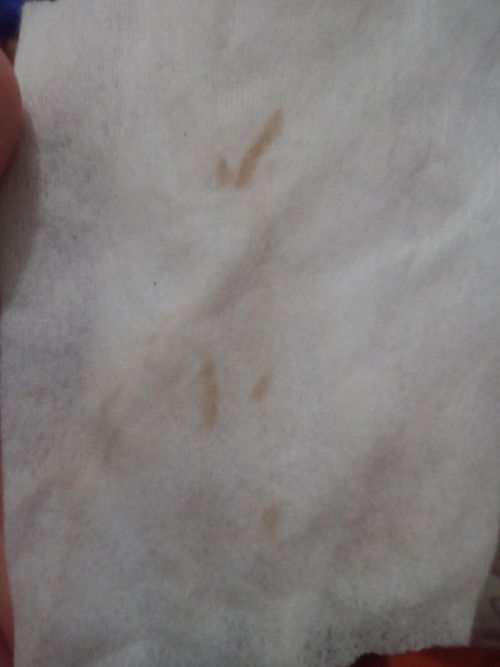 Mau nanya apakah ada yg sama Miss v aku dari kemarin ngeluarin seperti ini tpi sedikit