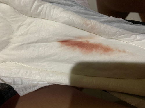 Flek tanda tanda lahiran kah bun