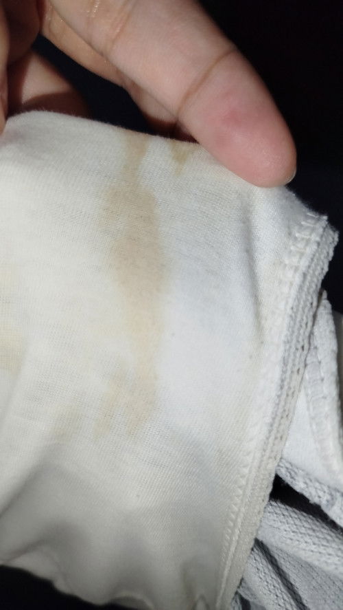 31 weeks pregnant, bakit po kaya ganito discharge ko at medyo masakit puson ko?