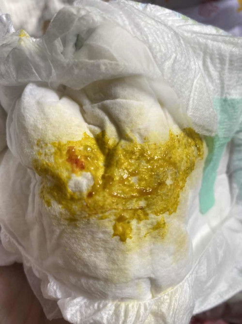 ขออนุญาตโพสภาพอึน้องนะคะ