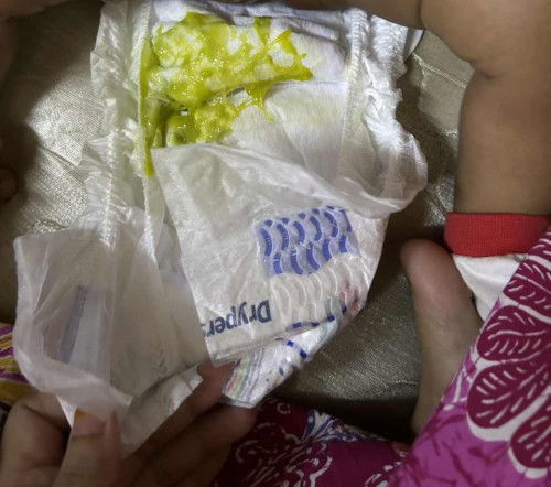 Najis Baby 1 bulan berlendir