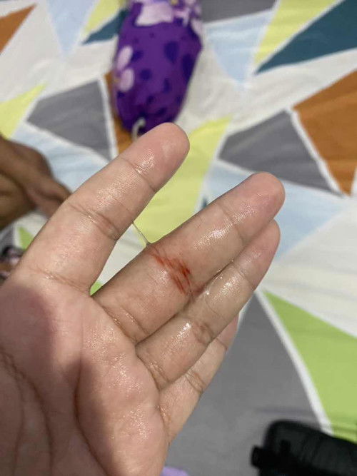 Keluar lendir bercampur darah