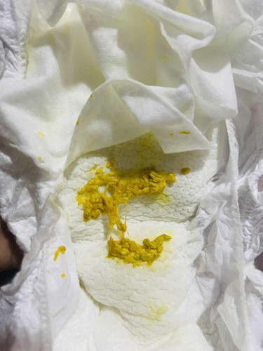 Baby Poo Texture