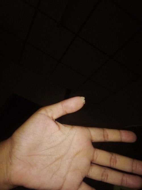 แม่ช่วยดูให้หน่อยนะค่ะกังวลมากใครมีตกขาวแบบนี้บ้างค่ะ