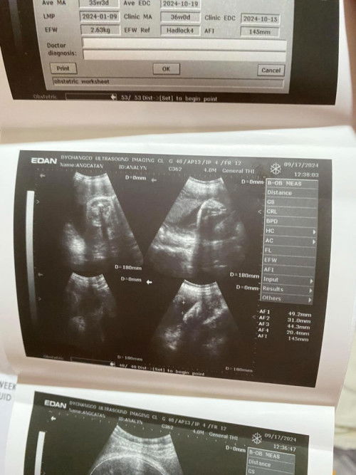 Pa identify naman ng GENDER