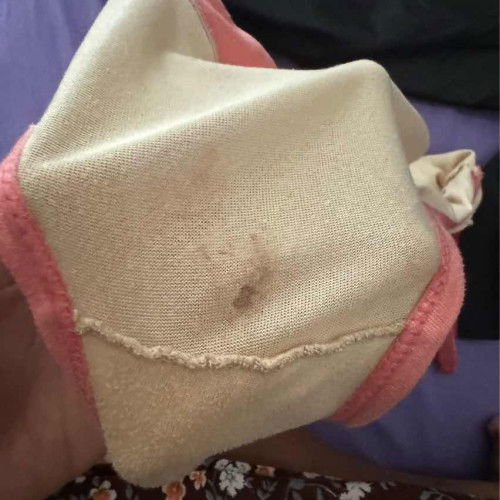 Flek usia kehamilan 7 minggu