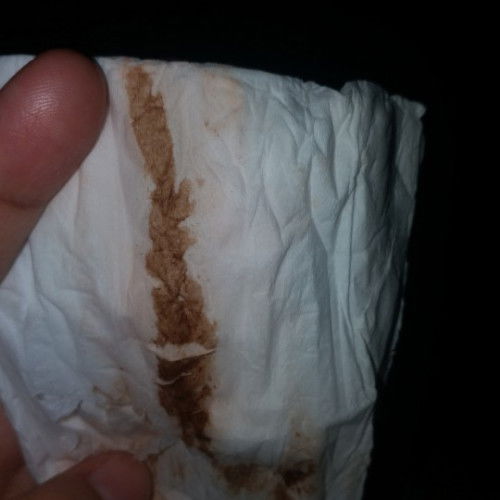 Kluar darah lebih ke gelap apakah mau lahiran /pembukaan ?