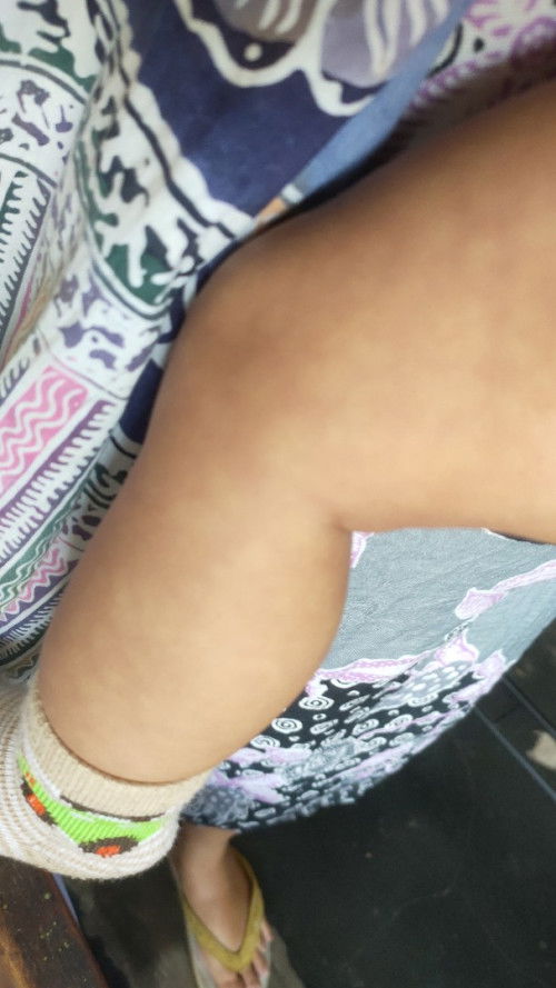 Normal kah anak setelah demam telapak kaki dingin