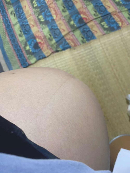 36w เต็ม 🤍🤰🏼