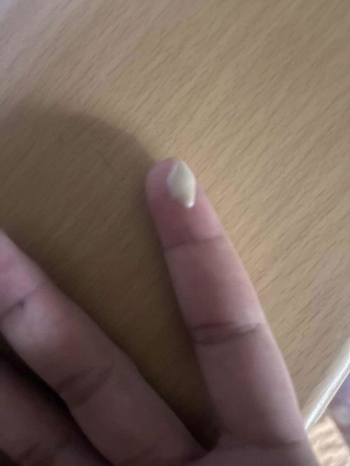 ตั้งครรภ์37+2วีค